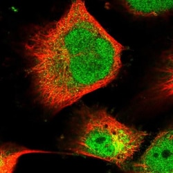 PLEKHG2 Antibody, Novus Biologicals 25 &mu;L, Unlabeled:Antibodies, Polyclonal